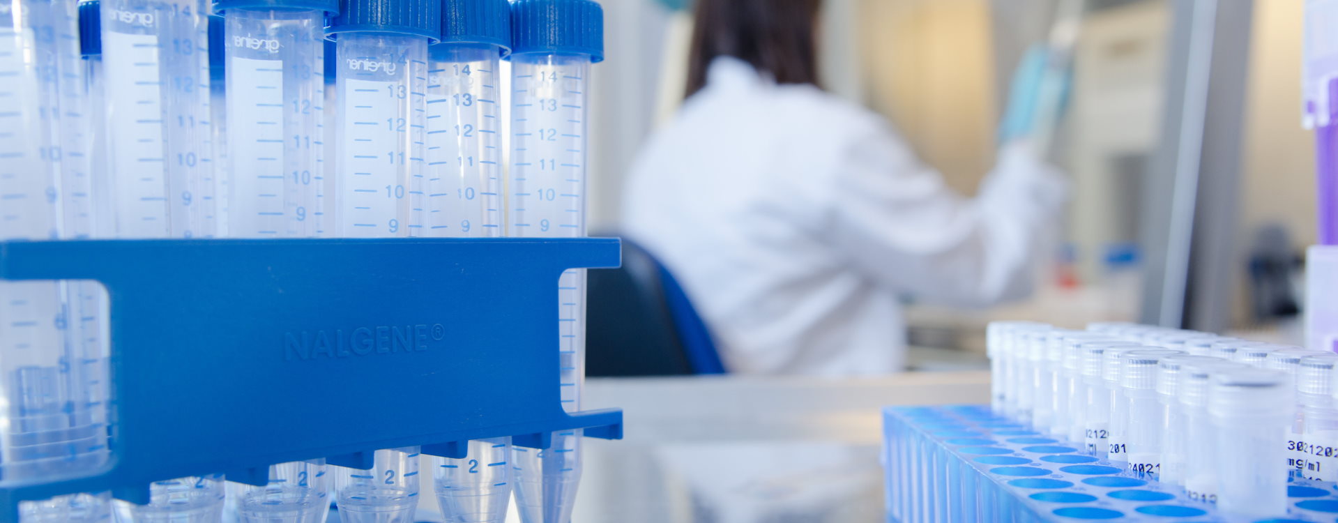 laboratory test samples in blue tubes 